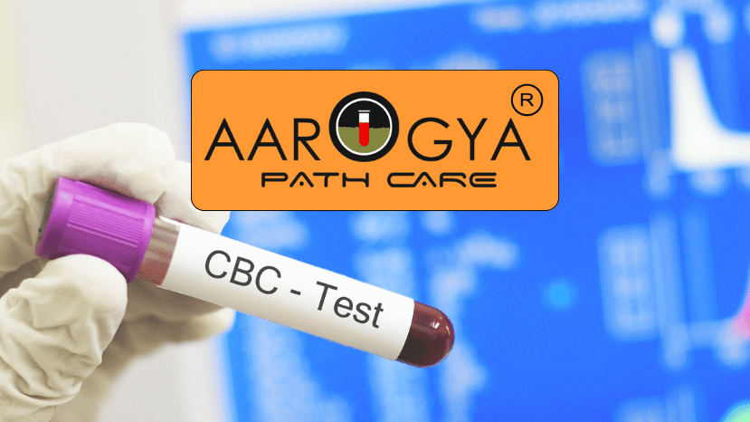 Complete Blood Test (CBC) In Delhi
